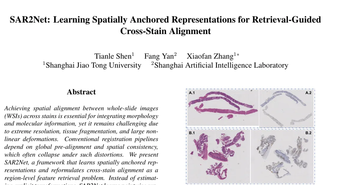SAR2Net: Learning Spatially Anchored Representations for Retrieval-Guided Cross-Stain Alignment
